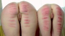 welted caned buttocks